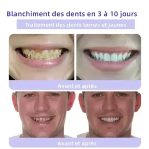 Winter Sale Oyikey™ Teeth Restoration Poudre Minérale