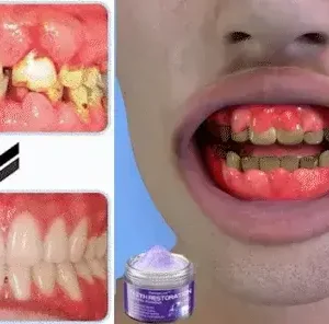 Winter Sale Oyikey™ Teeth Restoration Poudre Minérale