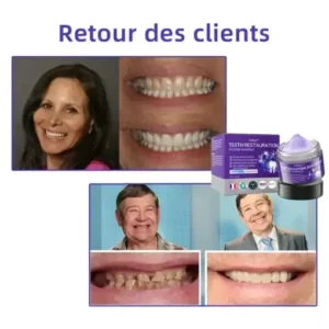 Winter Sale Oyikey™ Teeth Restoration Poudre Minérale