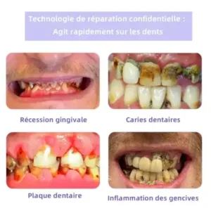 Winter Sale Oyikey™ Teeth Restoration Poudre Minérale